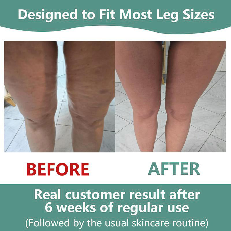 VELIORA™ Massage Roller