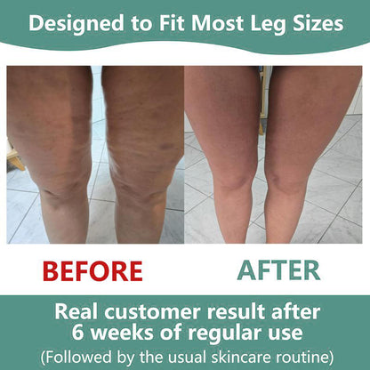 VELIORA™ Massage Roller