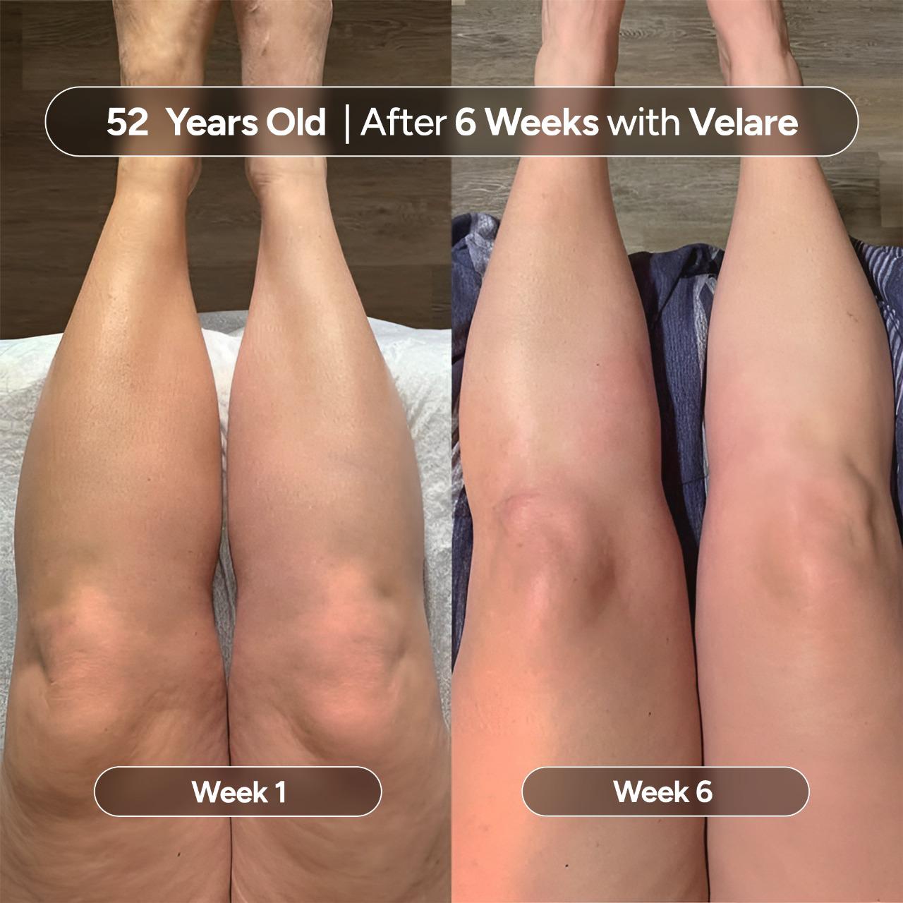 VELIORA™ Anti-Cellulite Massage Oil