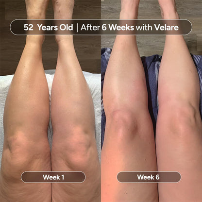 VELIORA™ Anti-Cellulite Massage Oil